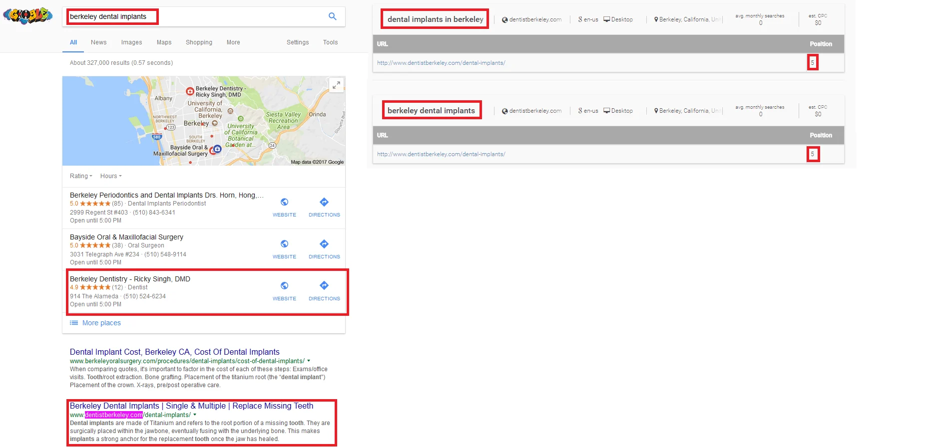 2nd in Google for Berkeley dental implants