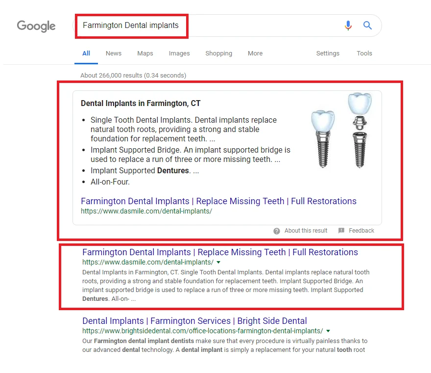 1st in Google for Farmington dental implants